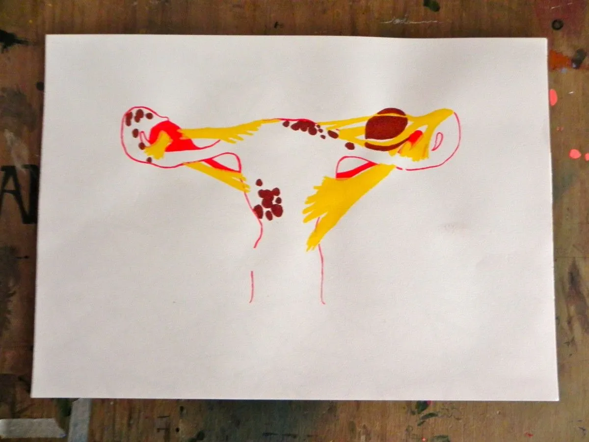 Uterus, œuvre de Soda Aw