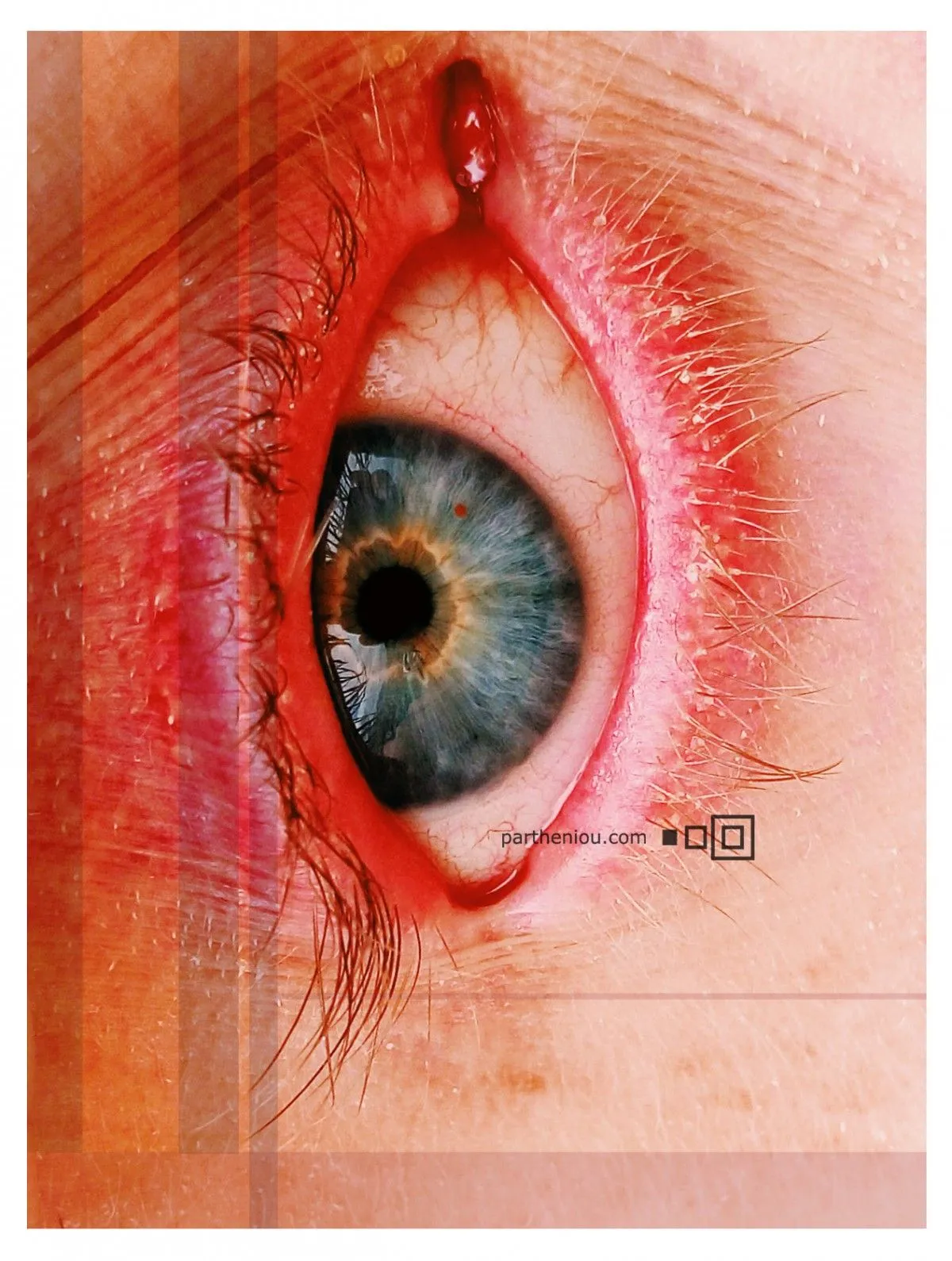 red-héteros/polychrome | bodyparts, œuvre de Panos Partheniou